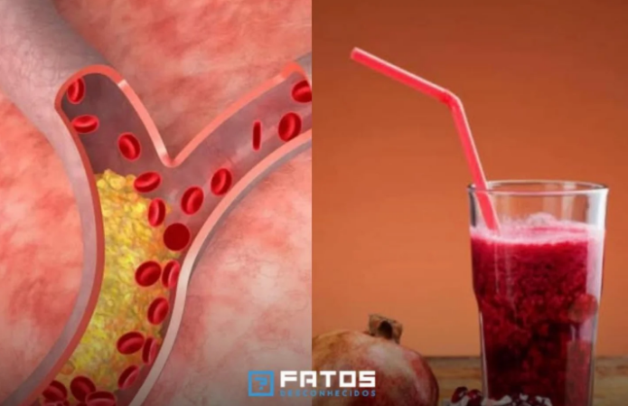 Um copo de suco de romã por dia pode reduzir em 30% obstrução das artérias
