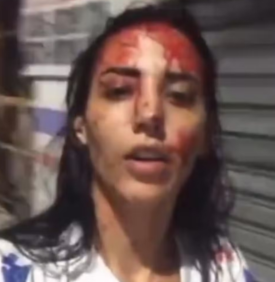 Mulher é detida após esfaquear namorado e alega sofrer violência doméstica em Maceió