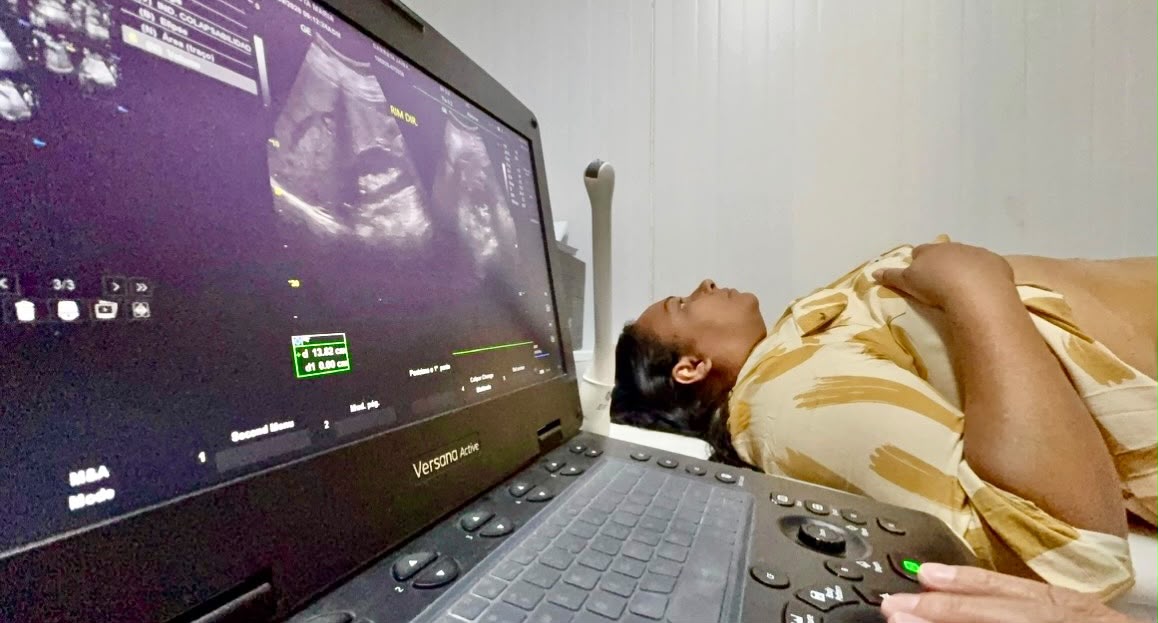 Carreta do Ministério da Saúde inicia atendimentos com exames de imagem em Senhor do Bonfim e atende pacientes de nove municípios