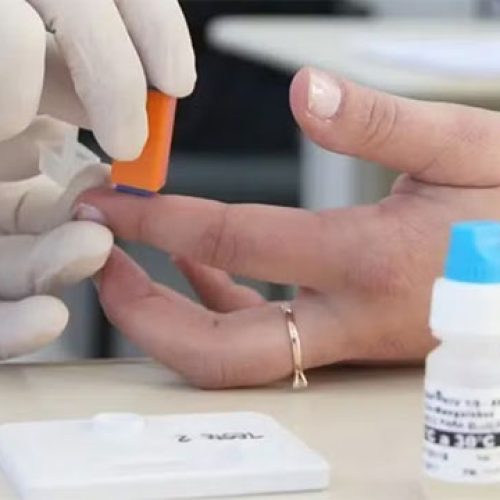 Secretaria de Saúde desmente surto de HIV entre jovens na Bahia