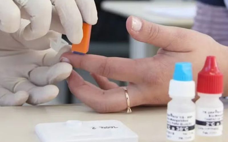 Secretaria de Saúde desmente surto de HIV entre jovens na Bahia