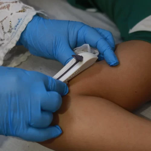 Fortaleza dá anticoncepcional para meninas a partir dos 10 anos