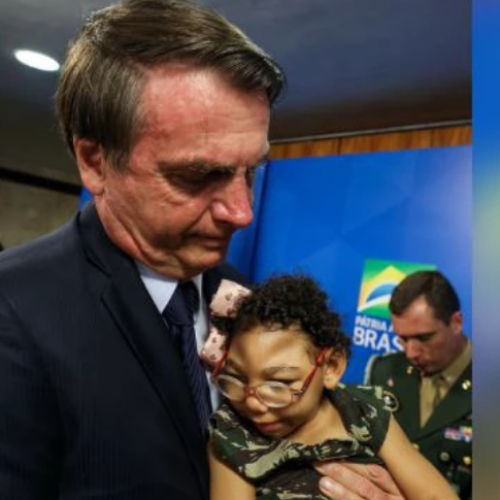 Microcefalia: Bolsonaro compara sua gestão com a de Lula