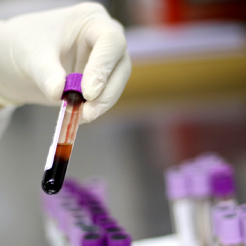 Ministério da Saúde descarta caso de gripe aviária em um trabalhador do Rio Grande do Sul