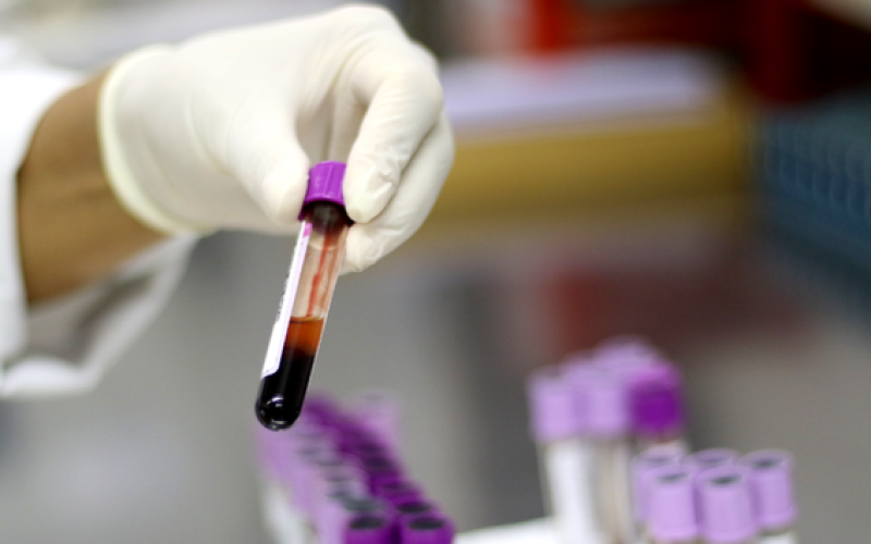 Ministério da Saúde descarta caso de gripe aviária em um trabalhador do Rio Grande do Sul