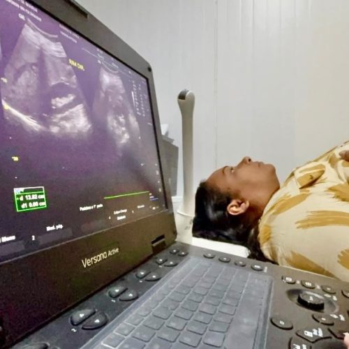 Carreta do Ministério da Saúde inicia atendimentos com exames de imagem em Senhor do Bonfim e atende pacientes de nove municípios