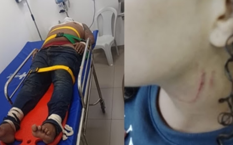 Estuprador agarra mulher pelo sutiã, convulsiona e tem parada cardíaca
