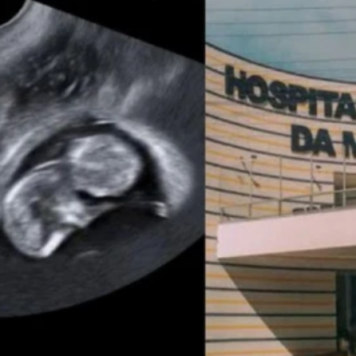 Prefeitura de Cabo Frio afasta médico após cesárea sem bebês