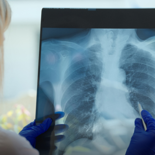 Uma faxina pode ser nocivo saúde igual a fumar 20 cigarros por dia