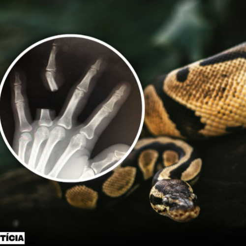 Homem é picado por cobra corta o dedo e ao chegar no hospital descobre que a cobra não era venenosa