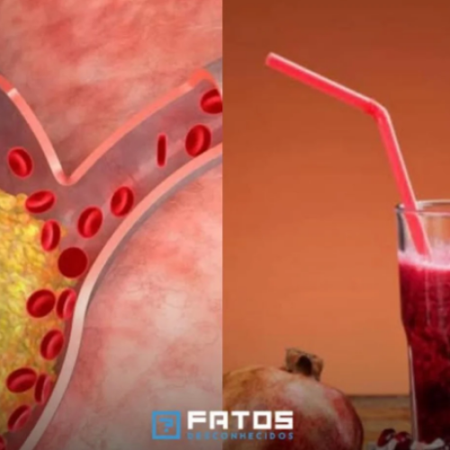 Um copo de suco de romã por dia pode reduzir em 30% obstrução das artérias