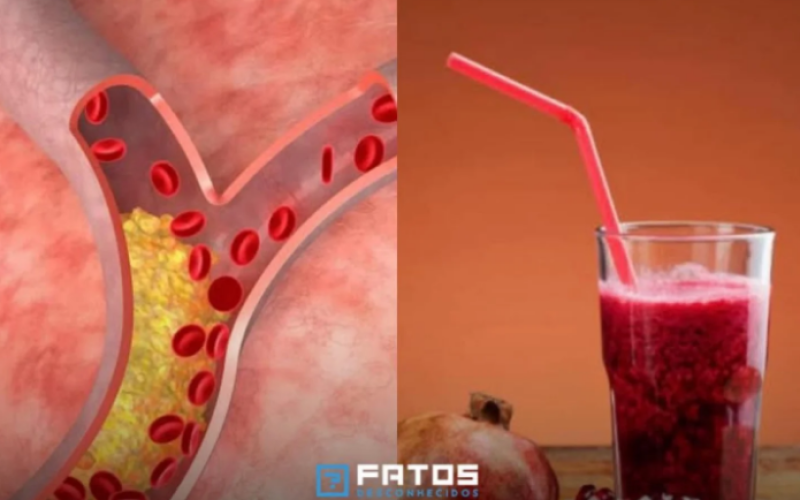 Um copo de suco de romã por dia pode reduzir em 30% obstrução das artérias