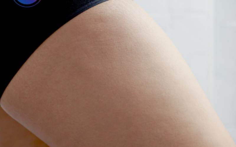 Estudo revela ação de remédio contra lipedema