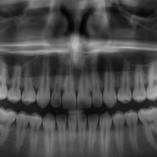 Inventando medicamento que faz dentes humanos crescer novamente