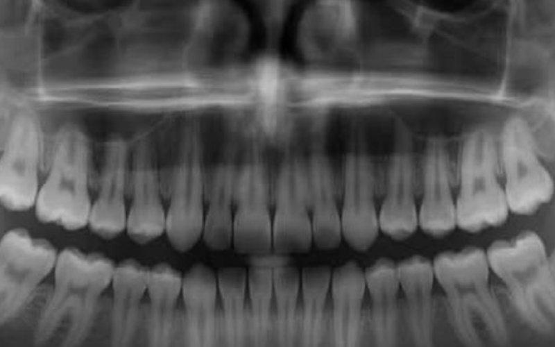 Inventando medicamento que faz dentes humanos crescer novamente