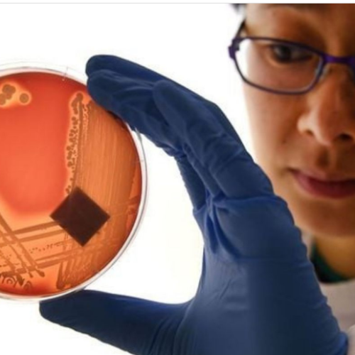 Resistencia ao antibiótico pode matar mais que o câncer