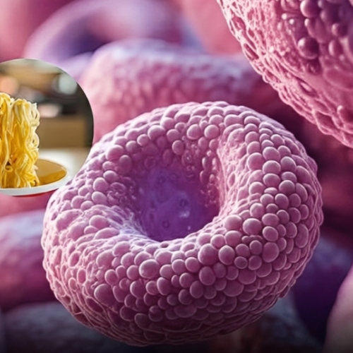 Estudos mostram que comer macarrão instantâneo 2 a 3 vezes por semana pode aumentar o risco de doenças cardíacas, AVC e diabetes