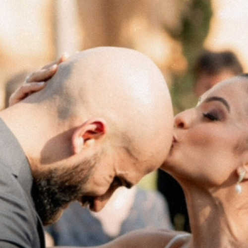 Por que as mulheres estão preferindo os carecas?