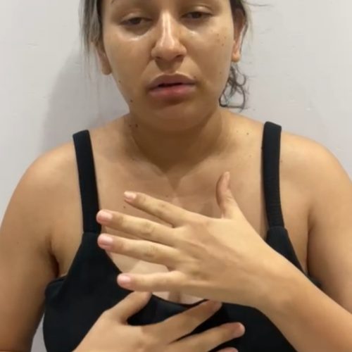 BONFIM: Mulher que teve parto complicado clama por regulação para salvar a criança!