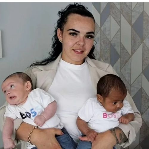 Mulher da a luz a gêmeos de pais diferentes