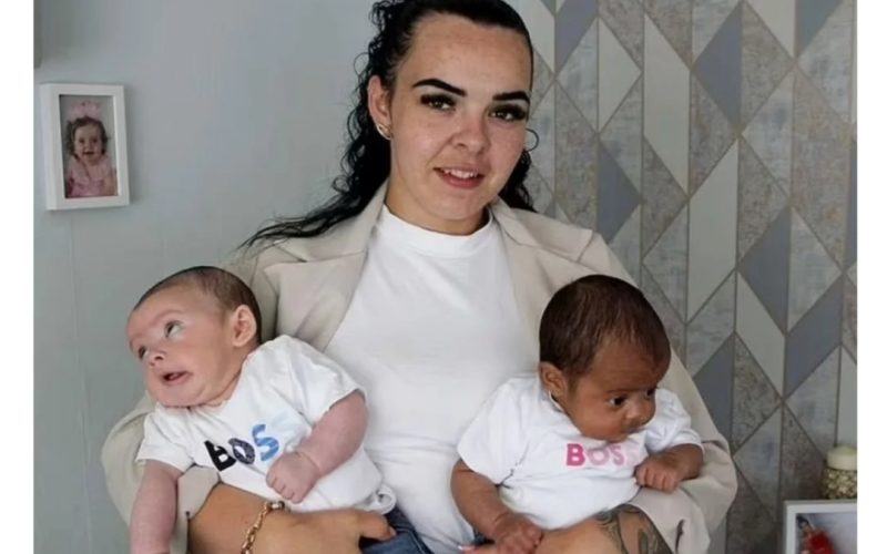 Mulher da a luz a gêmeos de pais diferentes