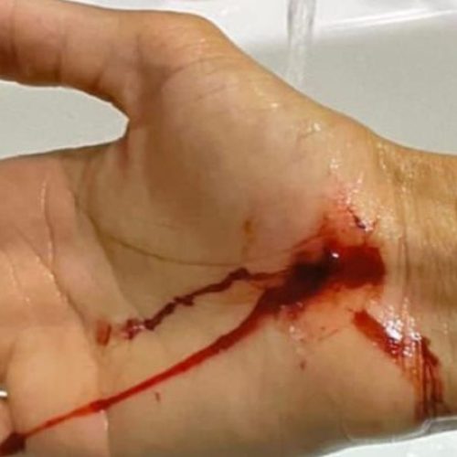 URGENTE: Estudantes relatam noite de terror na Unijorge; motivo é revelado
