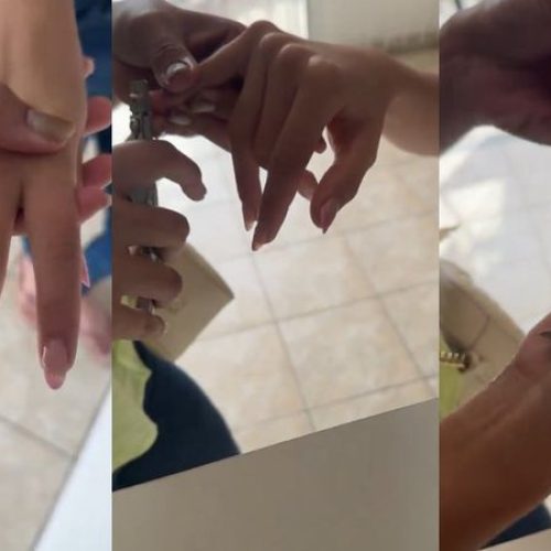 Manicure leva calote de adolescente de 17 anos e arranca todas as unhas com alicate
