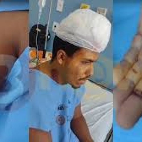 Homem recebe vários golpes de facão após reclamar de som alto em Ilhéus