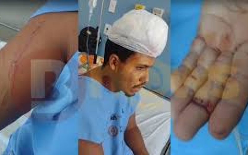 Homem recebe vários golpes de facão após reclamar de som alto em Ilhéus
