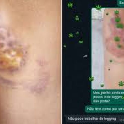 Mercado é condenado a indenizar funcionária após negar o direito do uso de calça legging;