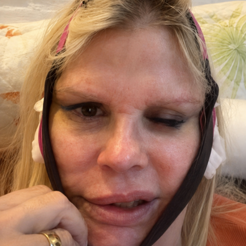 Monique Evans faz cirurgia facial e banco deixa de reconhecer biometria da apresentadora