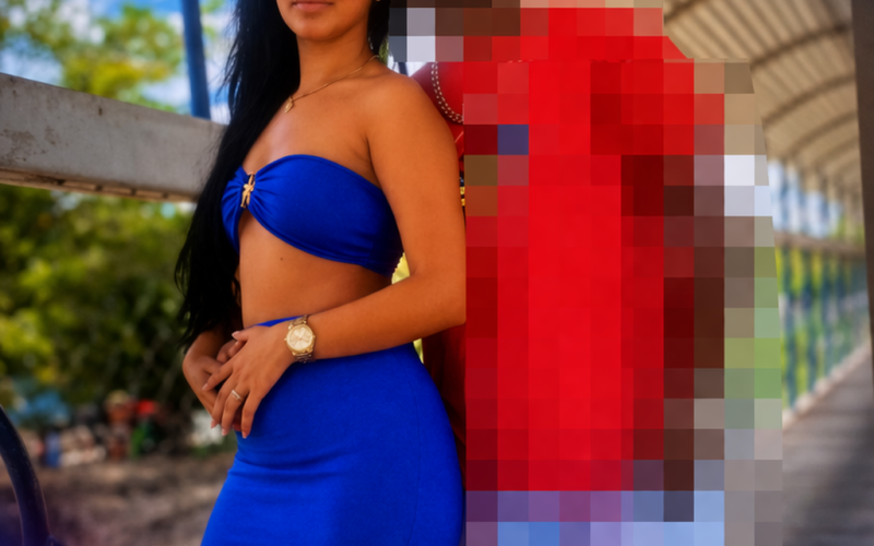 Mulher de 21 anos é baleada na cabeça em Cansanção