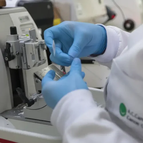 Cirurgia robótica para câncer de próstata é incorporada ao SUS