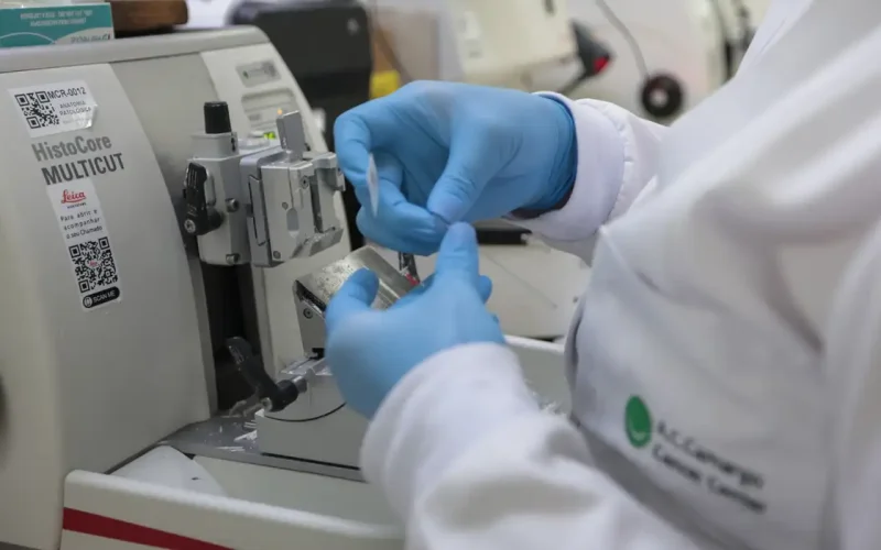 Cirurgia robótica para câncer de próstata é incorporada ao SUS