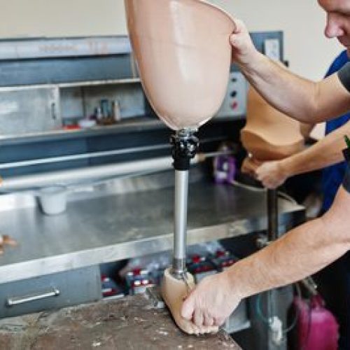 INSS entrega 48 próteses a trabalhadores no Rio de Janeiro em 2025